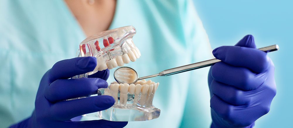 Advanced dental implants Ottawa
