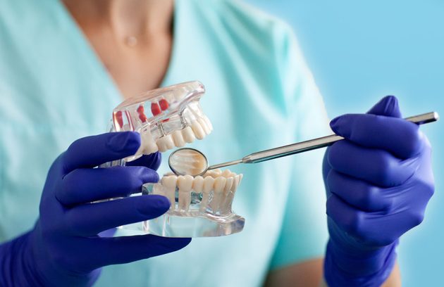 Advanced dental implants Ottawa