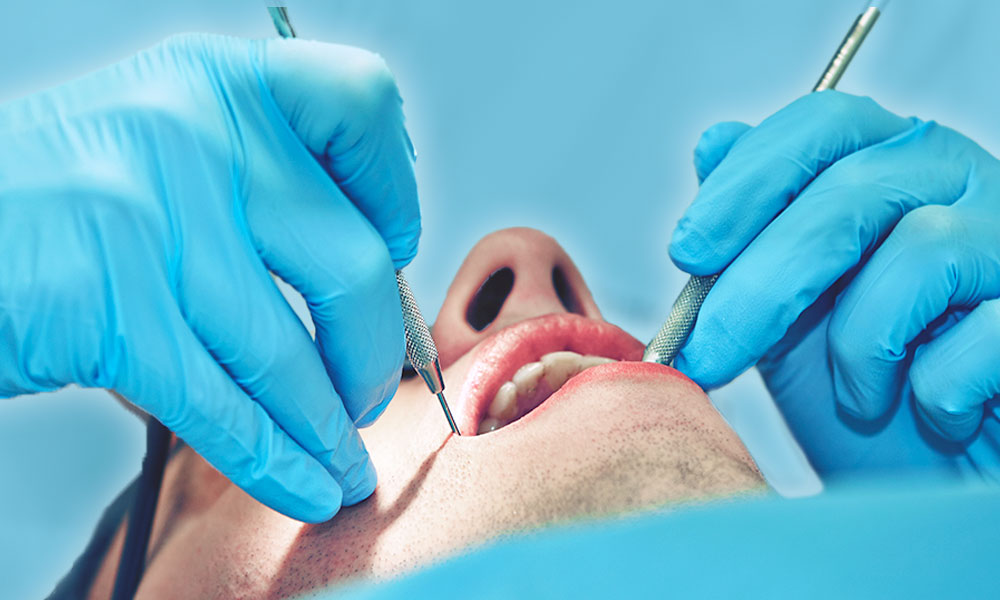 Advanced oral procedures Ottawa