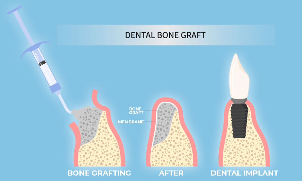 Ottawa maxillofacial surgeons