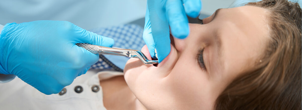 Wisdom Tooth Removal in Orleans: Safe, Comfortable Care at 750 Taylor Creek Drive