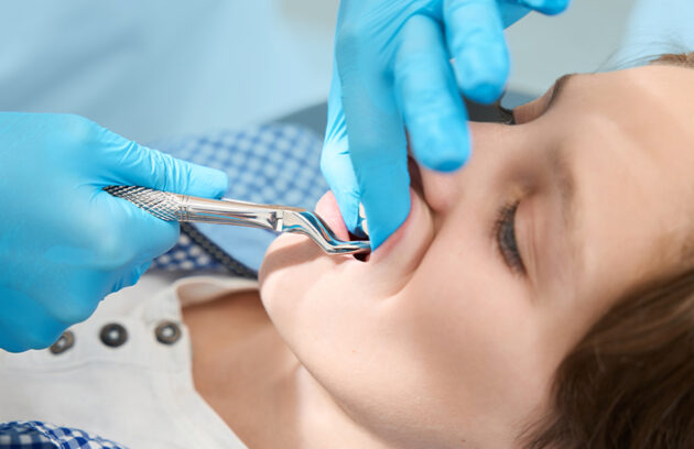 Wisdom Tooth Removal in Orleans: Safe, Comfortable Care at 750 Taylor Creek Drive