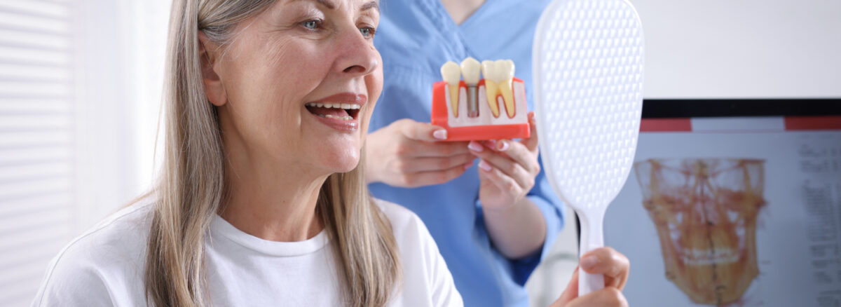 Can Dental Implants Last a Lifetime What Barrhaven Patients Need to Know