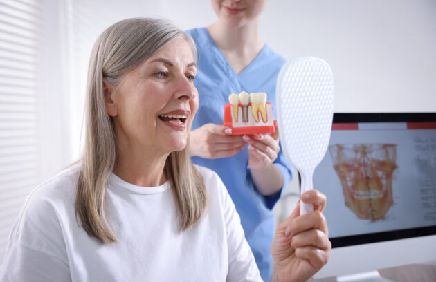 Can Dental Implants Last a Lifetime What Barrhaven Patients Need to Know