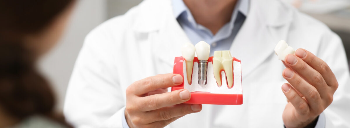 How Painful Are Dental Implants Separating Fact from Fiction for Barrhaven Patients